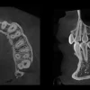 HDX Will Performance Radiology | Dentri Max 16x18 Panoramic | PR.NDA30.100.01.00 - Image 3